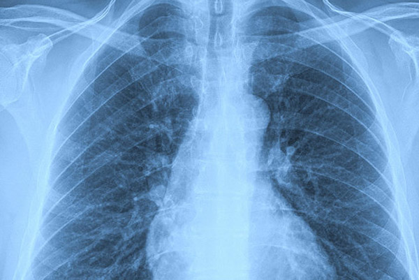 Xrays Dusk to Dawn Urgent Care